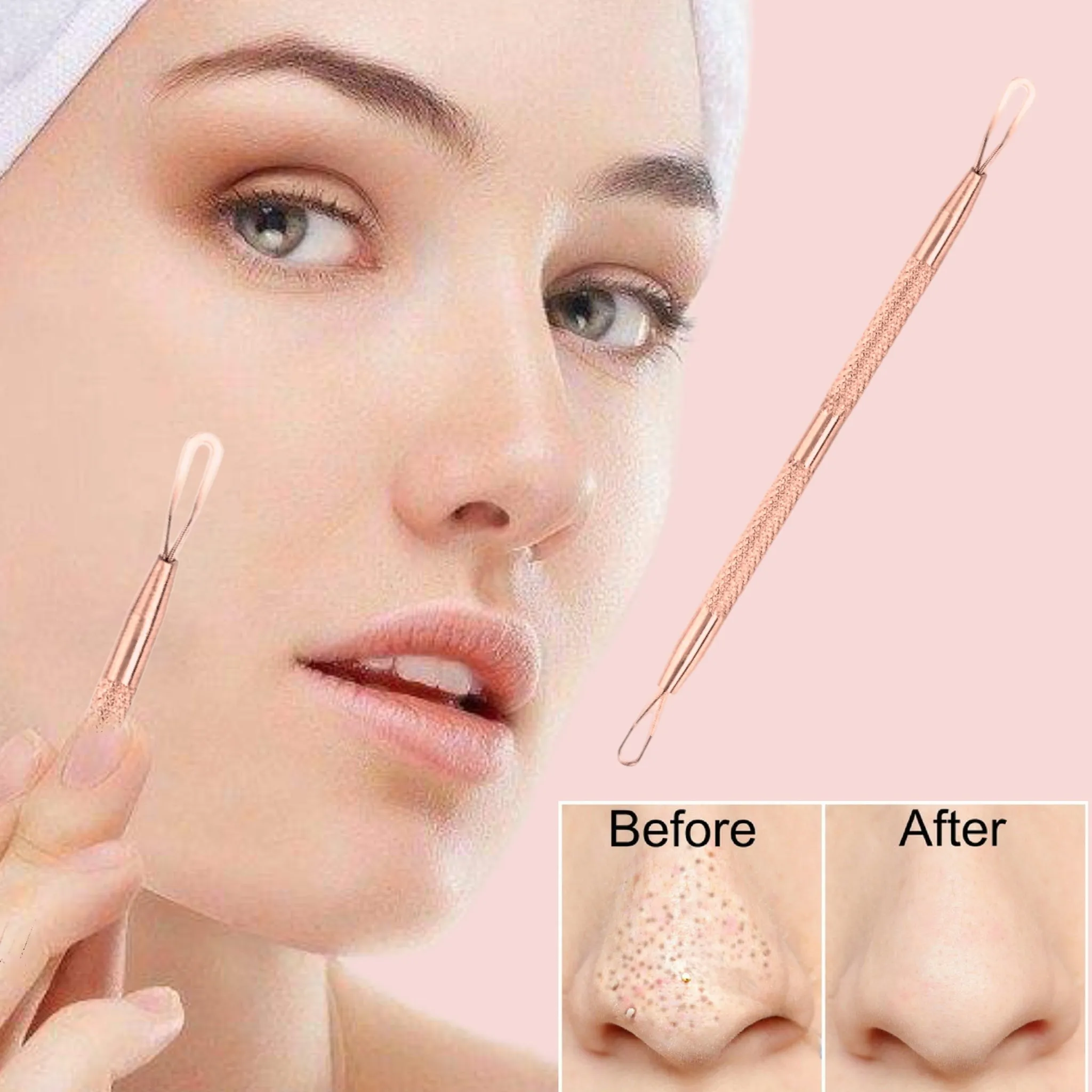 1 Professional Stainless Steel Blackhead Remover Blemish Extractor Tool – Acne Skin Nose Face Tzone Whitehead Zit Pimple Popper Comedone Pustule Removal Double Ended 2 in 1 Nonslip